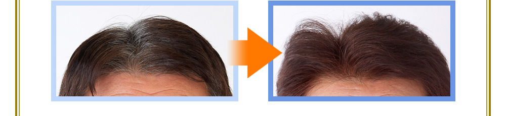 before after